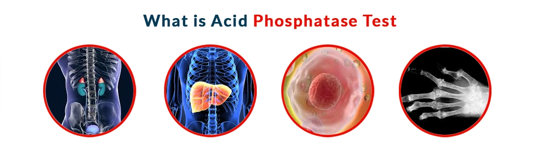 What is Acid Phosphatase Test